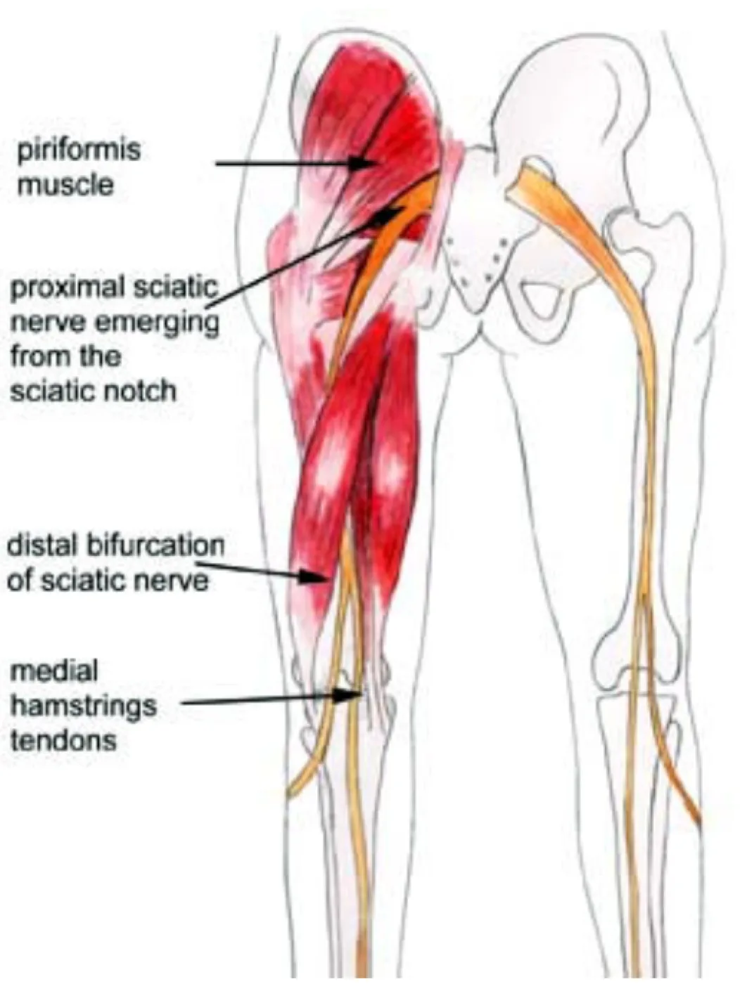 Sciatic Pain – What is it?